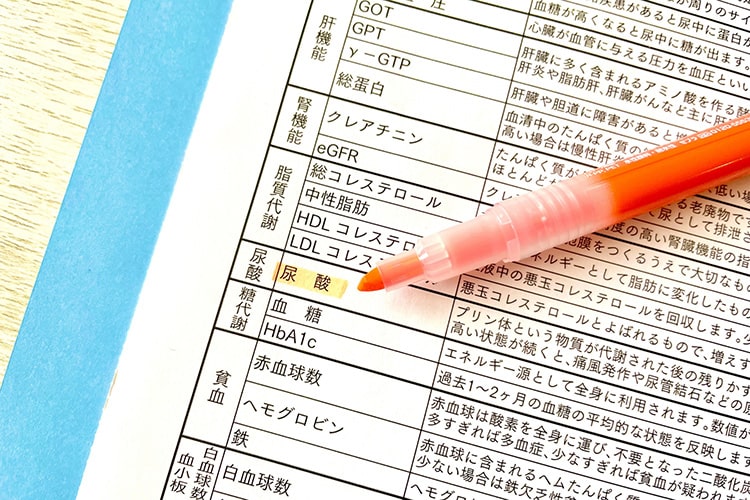 高尿酸血症について